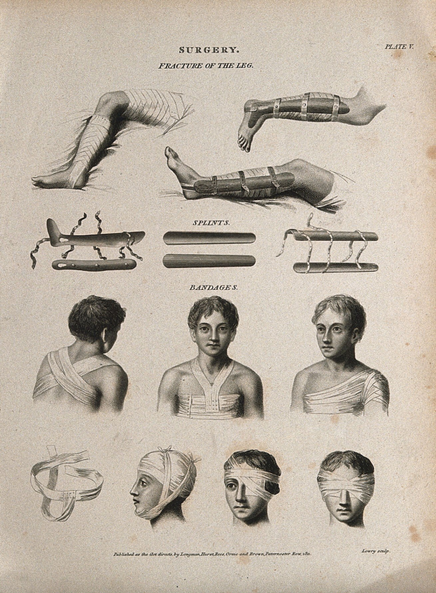 Schwarze-weiß-Illustration einer alten Buchseite mit den Beinen eines Mannes und dem Kopf einer Frau, beide mit Verband um den Kopf, begleitet von Text.